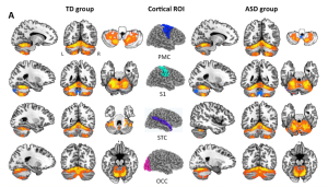 Functional cross-connections between the cerebellum and the four sensorimotor regions tested (center). TD = typically developing, ASD = autism spectrum disorder. From Khan et al 2015.